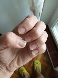 Sana Anima, Naturkosmetik, nat&uuml;rliche Kosmetikprodukte, Kosmetik, vegan, H&auml;nde, N&auml;gel, Pflege, Fingern&auml;gel, Entfernung von Plastikn&auml;geln, Nagelpflege, Vorher, Nagel&ouml;l